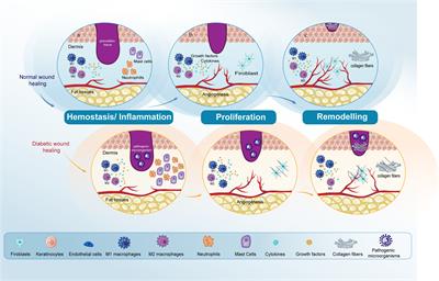 The emerging modulators of non-coding RNAs in diabetic wound healing